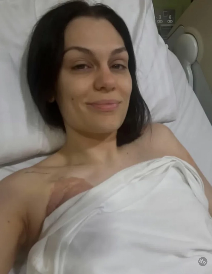 "Позволяю себе злиться". Джесси Джей, у которой обнаружили рак груди, рассказала о проведённой мастэктомии